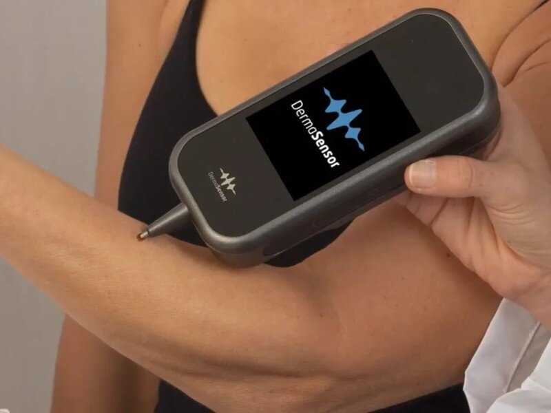 DermaSensor, a pocket-sized AI skin cancer detector, has been released DermaSensor, a pocket-sized AI skin cancer detector, has been released