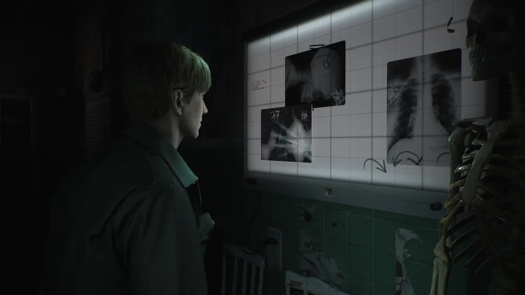 Silent Hill 2 remake: release date, trailers, gameplay and more | Image 2 Silent Hill 2
