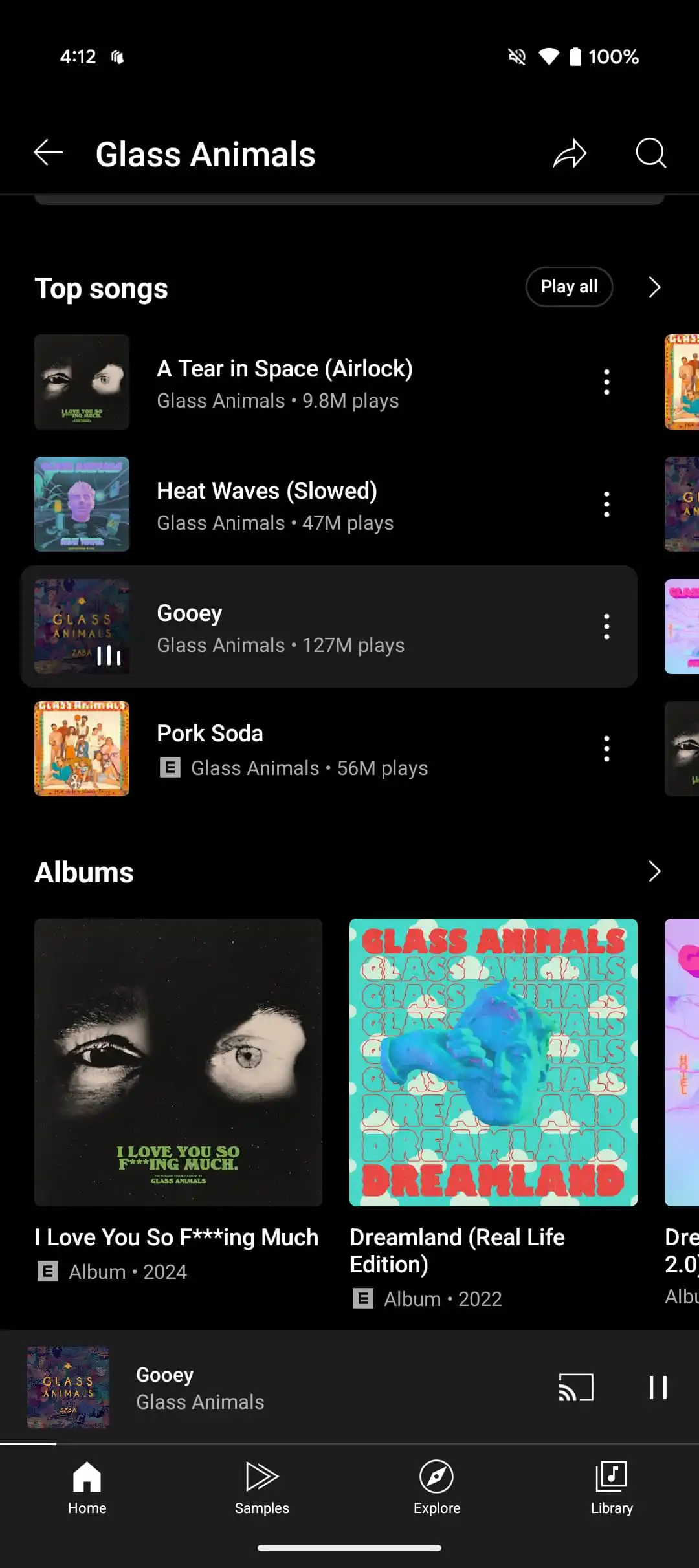 YouTube Music updates artist pages: new 'Top Songs' widget | Image 1 YouTube Music