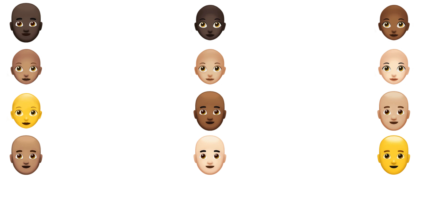 MyHair AI startup wants to change the approach to diagnosing baldness with its own AI models